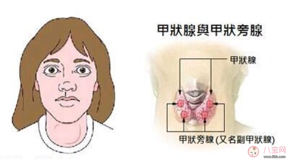 甲亢能懷孕嗎 甲亢懷孕對(duì)胎兒的影響 甲亢能懷孕嗎 甲亢懷孕對(duì)胎兒的影響