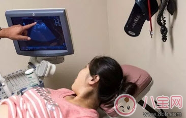 林心如愛吃甜食生女孩 懷孕如何測男女 林心如愛吃甜食生女孩 懷孕如何測男女