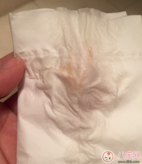 懷孕褐色分泌物是男孩 懷孕初期有褐色分泌物流出是男孩嗎 懷孕褐色分泌物是男孩 懷孕初期有褐色分泌物流出是男孩嗎