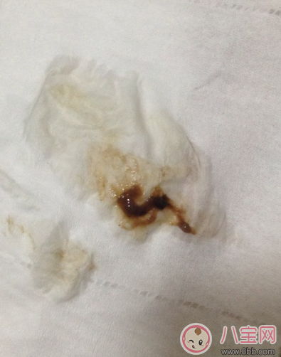 懷孕褐色分泌物是男孩 懷孕初期有褐色分泌物流出是男孩嗎 懷孕褐色分泌物是男孩 懷孕初期有褐色分泌物流出是男孩嗎