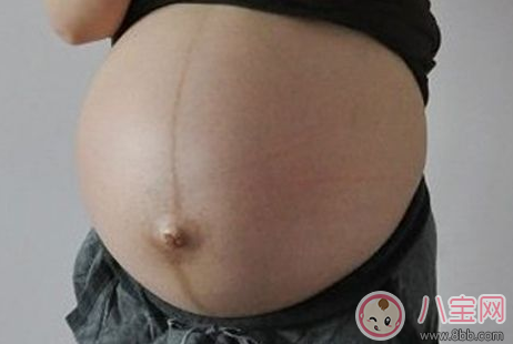 怎么通過(guò)妊娠紋判斷懷的是男是女    妊娠紋判斷性別方法