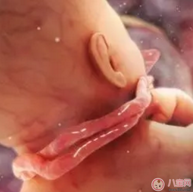 胎兒臍帶繞頸怎么辦？產(chǎn)前怎樣化解臍帶繞頸？