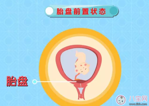 懷孕后那些情況不能順產(chǎn) 有些時候多聽醫(yī)囑準沒錯