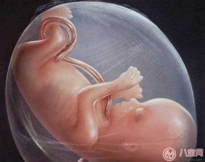 臍帶繞頸怎么辦 嬰兒臍帶繞頸嚴(yán)重嗎