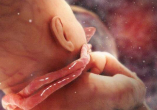 臍帶繞頸怎么辦 嬰兒臍帶繞頸嚴重嗎