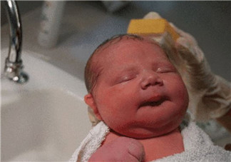 順產(chǎn)頭擠變形多久恢復 如何預防寶寶順產(chǎn)頭變形