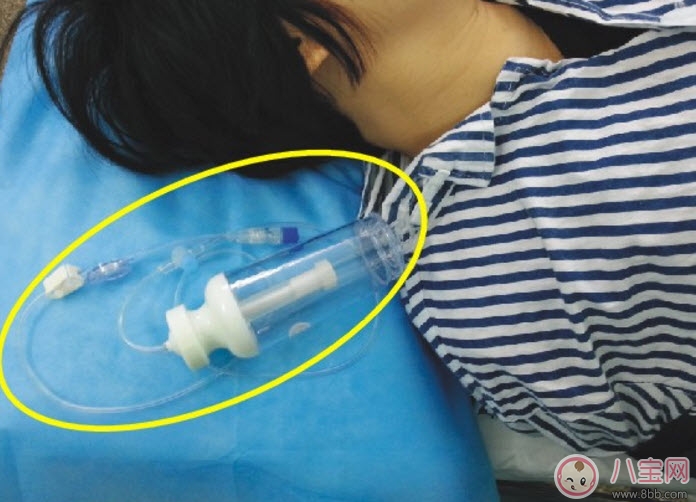 剖腹產(chǎn)的過程是怎么樣的 剖腹產(chǎn)手術(shù)前手術(shù)中手術(shù)后流程揭秘