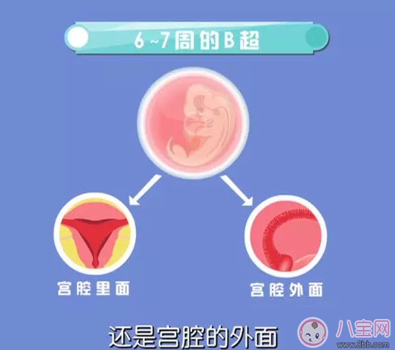 從懷孕到生要做幾次b超 懷孕做多少次b超合適(孕期b超時(shí)間表) 從懷孕到生要做幾次b超 懷孕做多少次b超合適(孕期b超時(shí)間表)