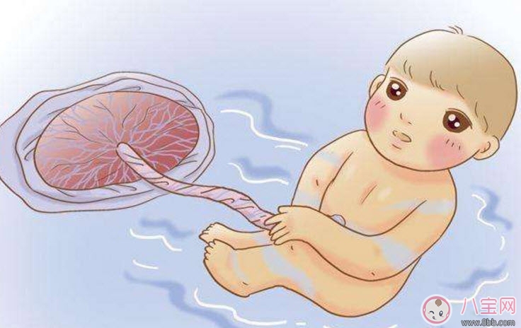 孕晚期羊水過多怎么辦 羊水過多的原因 孕晚期羊水過多怎么辦 羊水過多的原因