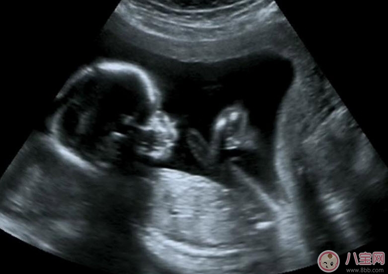 孕早期做陰道B超會(huì)影響胎兒?jiǎn)?陰式b超和b超的區(qū)別 孕早期做陰道B超會(huì)影響胎兒?jiǎn)?陰式b超和b超的區(qū)別