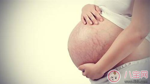 妊娠紋什么時候長    怎么預防妊娠紋