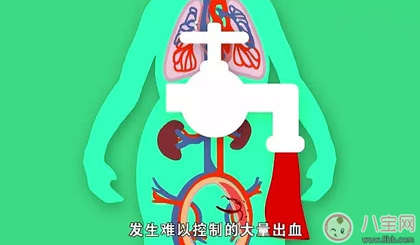 哪些人更容易產(chǎn)后出血 產(chǎn)后出血發(fā)病癥狀(如何預(yù)防產(chǎn)后大出血) 哪些人更容易產(chǎn)后出血 產(chǎn)后出血發(fā)病癥狀(如何預(yù)防產(chǎn)后大出血)