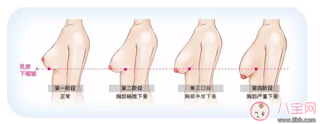 母乳喂養(yǎng)會(huì)造成胸部下垂 錯(cuò)!真相其實(shí)是這樣 母乳喂養(yǎng)會(huì)造成胸部下垂 錯(cuò)!真相其實(shí)是這樣
