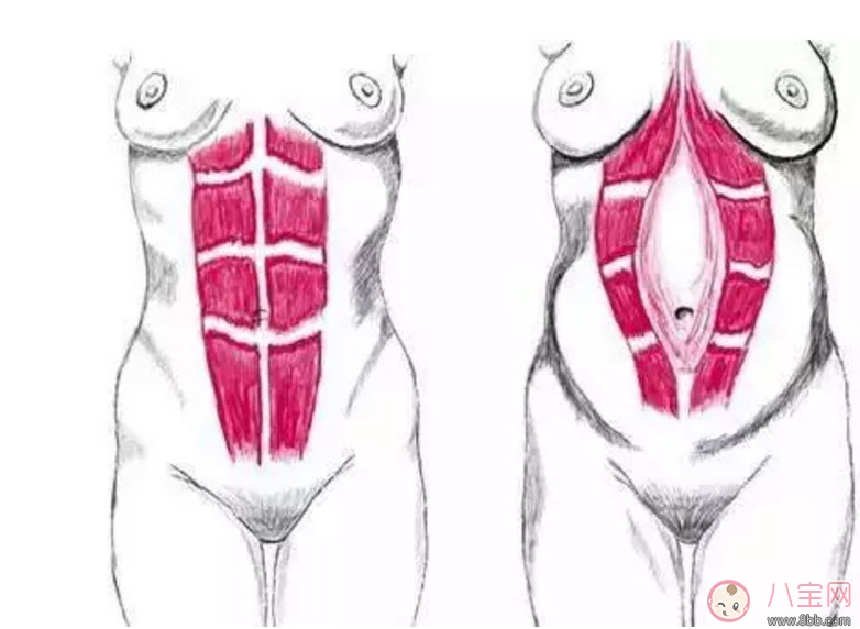 孕后如何在七夕擁有完美身材 孕后塑型這樣做