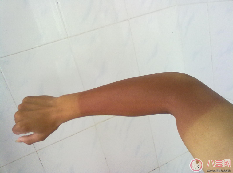 甜馨又曬黑了 如何拯救易曬黑體質(zhì)