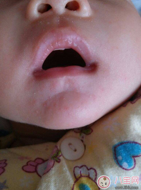 秋季寶寶嘴唇易起皮 寶寶使用唇膏推薦 秋季寶寶嘴唇易起皮 寶寶使用唇膏推薦