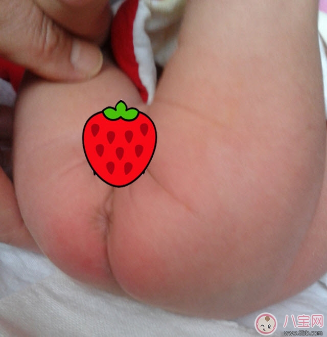 貝親護臀膏可以擦臉嗎 貝親嬰兒護臀膏能天天用嗎