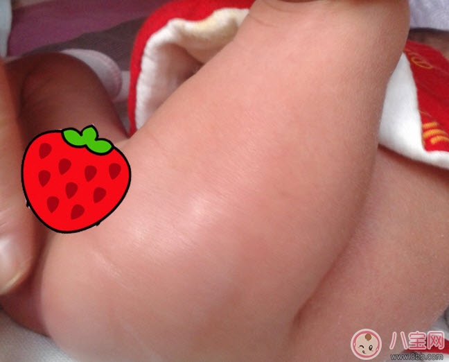 貝親護臀膏可以擦臉嗎 貝親嬰兒護臀膏能天天用嗎