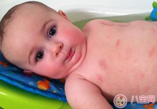 這些情況居然是奶粉過(guò)敏 怎么知道孩子吃奶粉過(guò)敏了 這些情況居然是奶粉過(guò)敏 怎么知道孩子吃奶粉過(guò)敏了