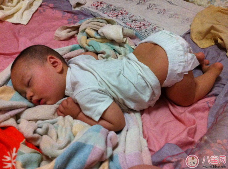 寶寶痱子總不消 用用這個準(zhǔn)會好