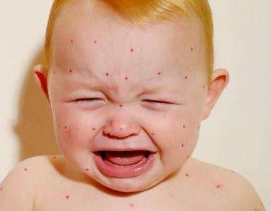 風(fēng)油精寶寶能用嗎 寶寶使用風(fēng)油精的危害 風(fēng)油精寶寶能用嗎 寶寶使用風(fēng)油精的危害