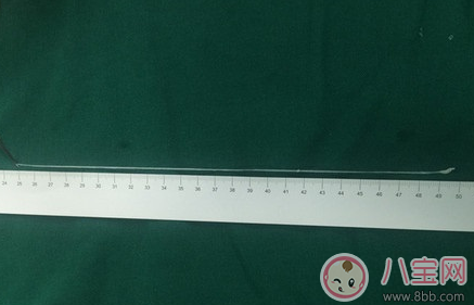 喝生水長(zhǎng)寄生蟲(chóng)是真的嗎 喝生水會(huì)有寄生蟲(chóng)嗎 喝生水長(zhǎng)寄生蟲(chóng)是真的嗎 喝生水會(huì)有寄生蟲(chóng)嗎