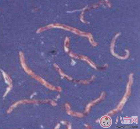 喝生水長(zhǎng)寄生蟲(chóng)是真的嗎 喝生水會(huì)有寄生蟲(chóng)嗎 喝生水長(zhǎng)寄生蟲(chóng)是真的嗎 喝生水會(huì)有寄生蟲(chóng)嗎