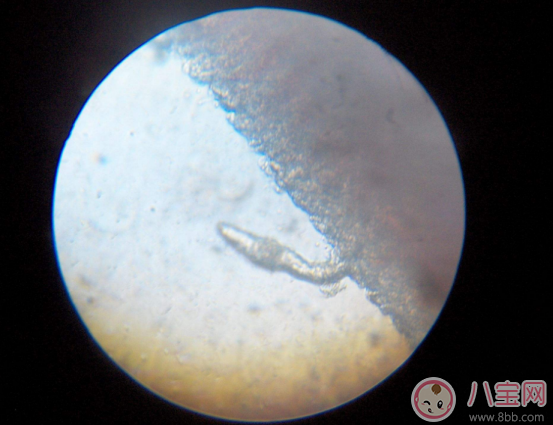 喝生水長(zhǎng)寄生蟲(chóng)是真的嗎 喝生水會(huì)有寄生蟲(chóng)嗎 喝生水長(zhǎng)寄生蟲(chóng)是真的嗎 喝生水會(huì)有寄生蟲(chóng)嗎