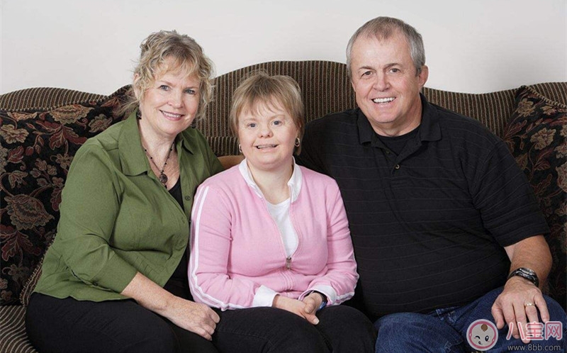 唐氏癥寶寶典型癥狀 如何治療唐氏癥寶寶