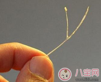 寶寶吃魚(yú)卡魚(yú)刺 急著自己去夾刺就大錯(cuò)特錯(cuò)了