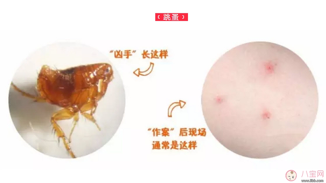 寶寶被跳蚤咬了癥狀圖片 寶寶被跳蚤咬和蚊子咬癥狀對(duì)比圖片區(qū)別
