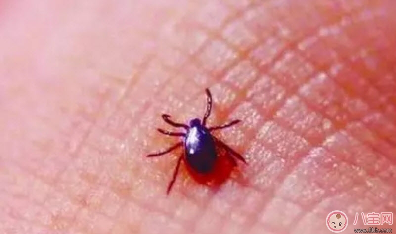 寶寶被蜱蟲咬了癥狀圖片 寶寶被蜱蟲咬和蚊子咬癥狀對(duì)比圖片區(qū)別