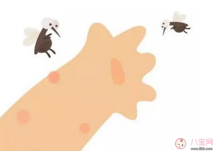 寶寶被臭蟲咬了癥狀圖片 寶寶被臭蟲咬和蚊子咬癥狀對比圖片區(qū)別