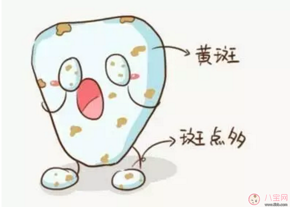 寶寶沒(méi)有齲齒 卻有黑牙是怎么回事？