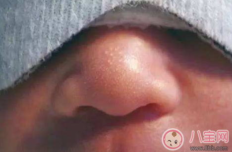 新生兒鼻尖上起了好多小白點(diǎn)是什么 寶寶鼻子上有小白點(diǎn)