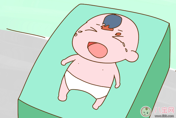 寶寶為什么會長胎記 暗紅色/棕色胎記是危害健康的 寶寶為什么會長胎記 暗紅色/棕色胎記是危害健康的