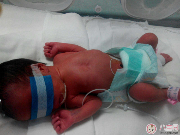早產(chǎn)寶寶太小怎么照顧 各項注意到一樣是個健康寶寶