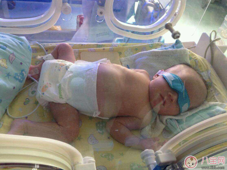 早產(chǎn)寶寶太小怎么照顧 各項注意到一樣是個健康寶寶