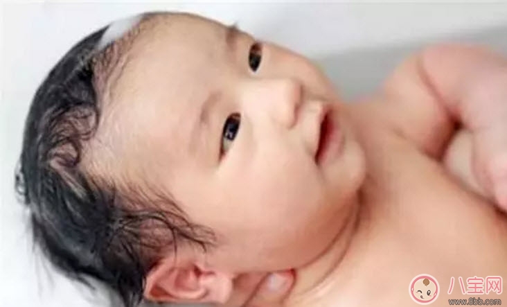 新生兒頭上的乳痂一般什么時候消失 為什么有的寶寶長乳痂有的不長