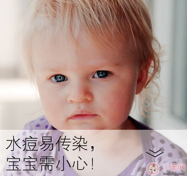 孩子長水痘這些東西千萬遠離 孩子水痘好得快方法