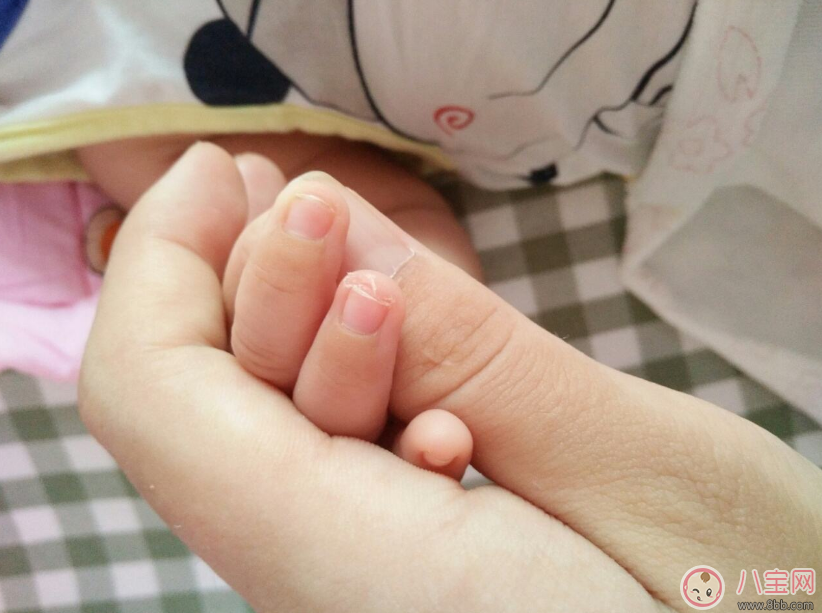 寶寶指甲暗藏大奧秘 從指甲也能看出寶寶的健康狀況 寶寶指甲暗藏大奧秘 從指甲也能看出寶寶的健康狀況