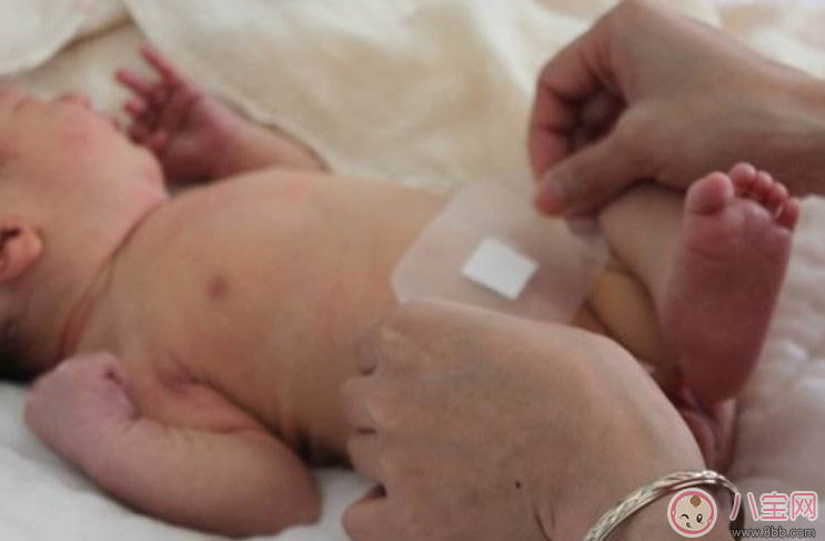 看到孩子肚臍這四種情況要當(dāng)心 最好早點(diǎn)及時(shí)就醫(yī)