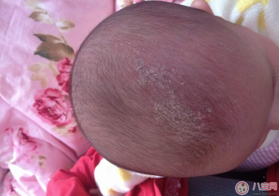 孩子其實(shí)這些地方特別臟 洗的時(shí)候千萬別忘 孩子其實(shí)這些地方特別臟 洗的時(shí)候千萬別忘