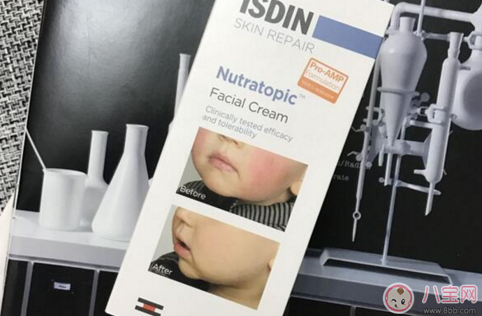 痱子和濕疹有什么區(qū)別 怎么預防痱子和濕疹