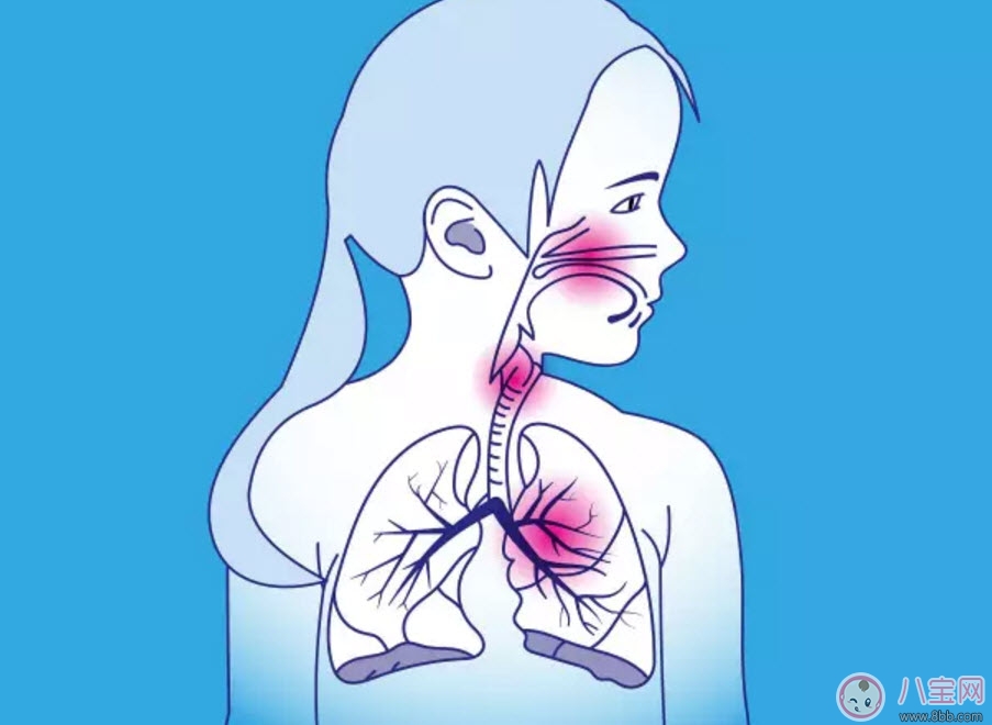 寶寶肺炎反反復(fù)復(fù)怎么辦 寶寶得了肺炎怎么治療