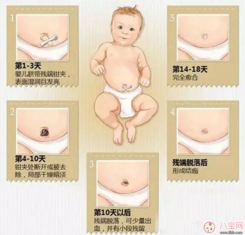 新生兒臍帶脫落的時(shí)間是幾天 新生兒臍帶脫落的過(guò)程圖解 新生兒臍帶脫落的時(shí)間是幾天 新生兒臍帶脫落的過(guò)程圖解