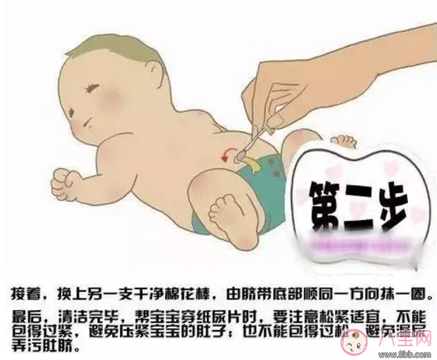 新生兒臍帶消毒用什么 臍帶消毒用碘伏好還是酒精(肚臍消毒圖解)