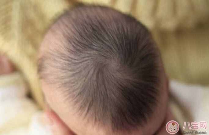 夏天寶寶出汗多是什么原因 寶寶出汗和虛汗的區(qū)別 夏天寶寶出汗多是什么原因 寶寶出汗和虛汗的區(qū)別