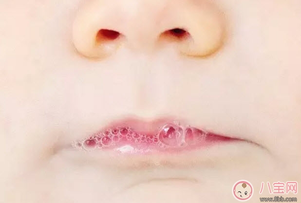 寶寶吐泡泡就是肺炎嗎 寶寶吐泡泡是怎么回事