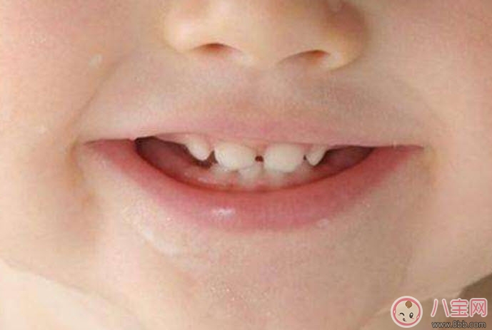 寶寶長牙順序 寶寶長牙特征(寶寶長牙癥狀)
